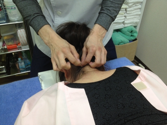 首、肩、腕、腰どこに行っても改善しなかった方!はり治療はじめませんか?